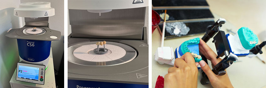 Sievers-Prothetik-Cerec+Artikulator Sievers-Prothetik-Cerec+Artikulator