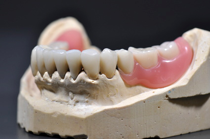 Zahnarztpraxis Dr. Sievers Prothetik Zahn-Prothese Zahnarztpraxis Dr. Sievers Prothetik Zahn-Prothese